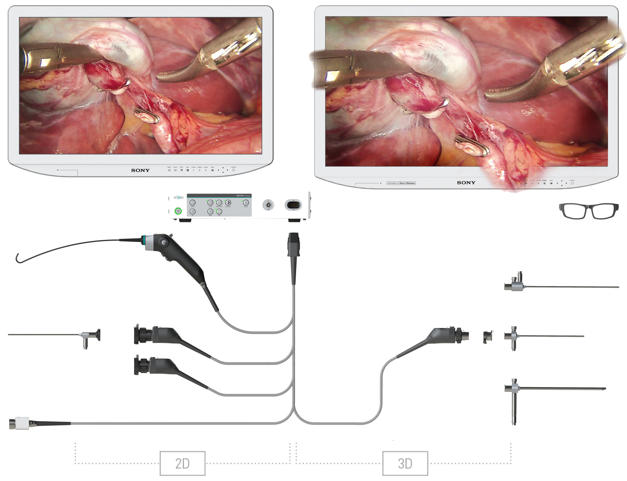 16389552935201.jpg 艾克松XION技术1.jpg